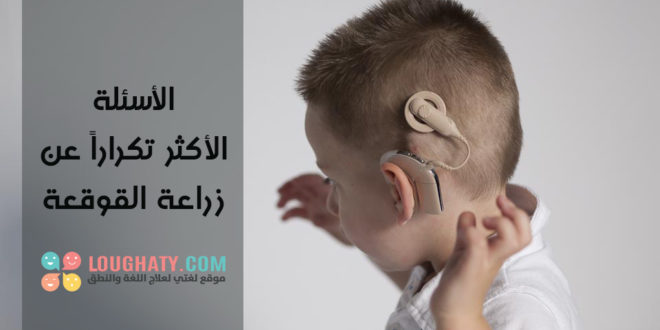 زراعة القوقعة